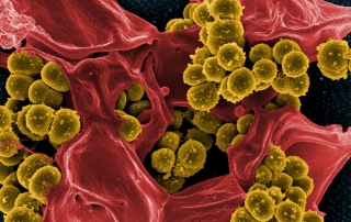 Bacteria in Water Supplies